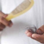 Alopecia juga beresiko pada wanita